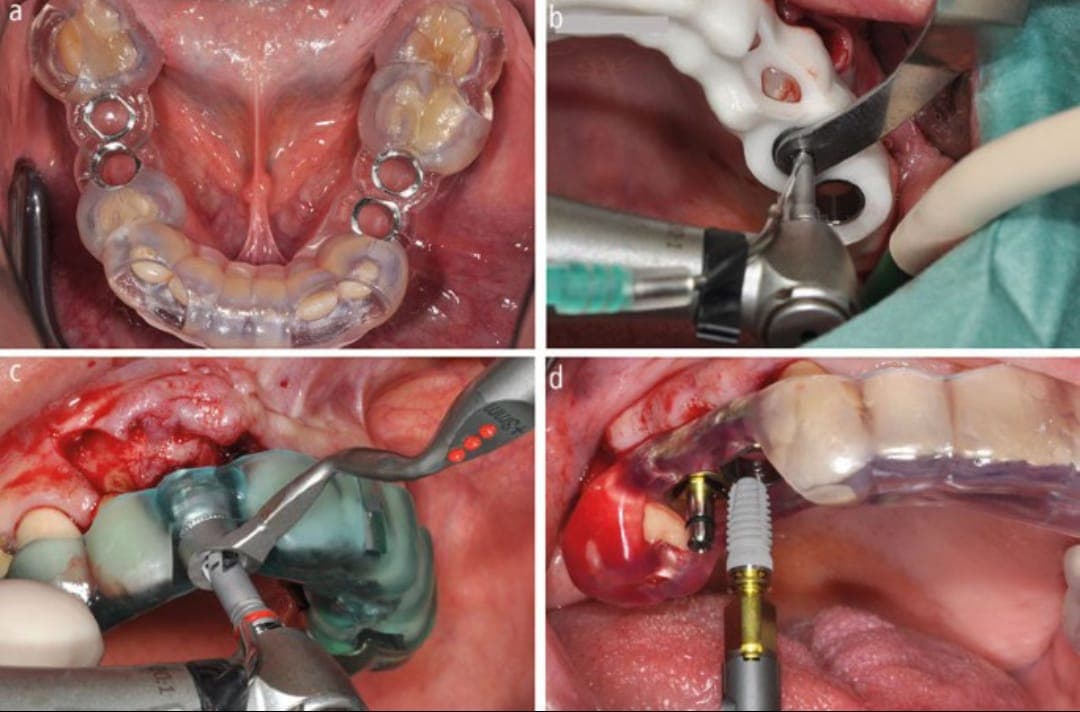 Another happy patient showing off their new smile.
